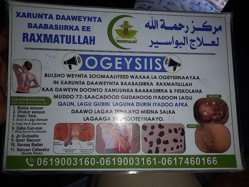 مركز علاج بايباسيirka الرحمت الله