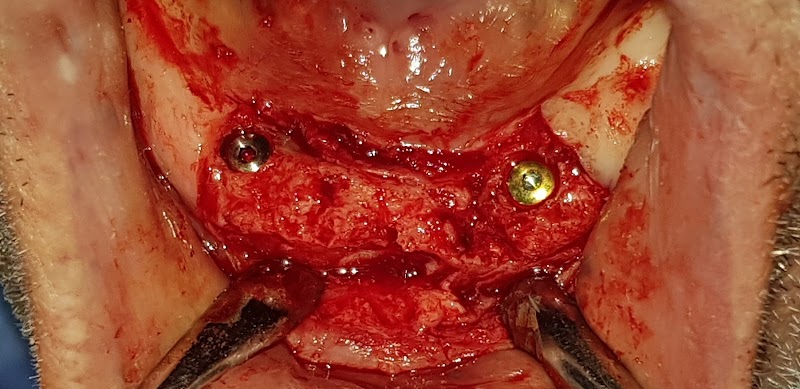 عيادة الأسنان د. محمد مبروكي \ جراحة وزراعة الفم 4