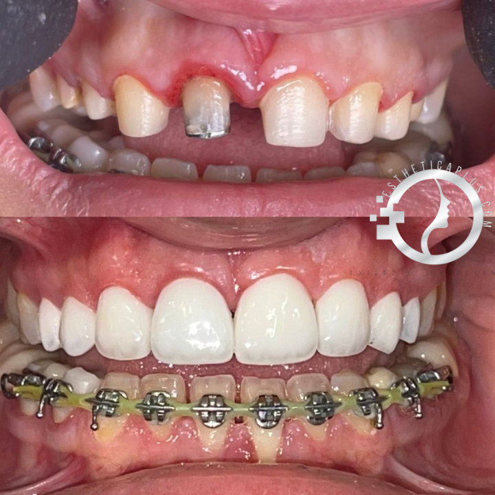 عيادة أسنان استيتيكابلس