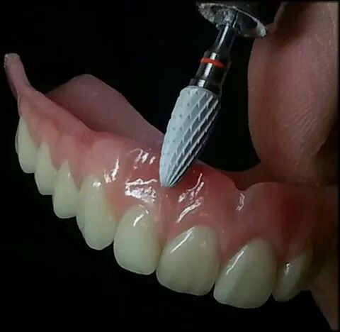 مخبر اسنان 2