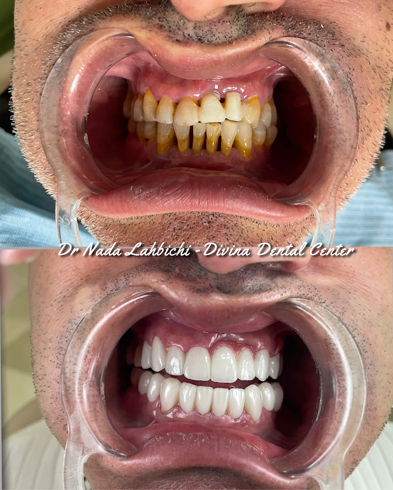 طبيب أسنان طنجة - مركز ديفينا لطب الأسنان | الدكتورة ندى لهيبشي، أخصائية في طب الأسنان التجميلي