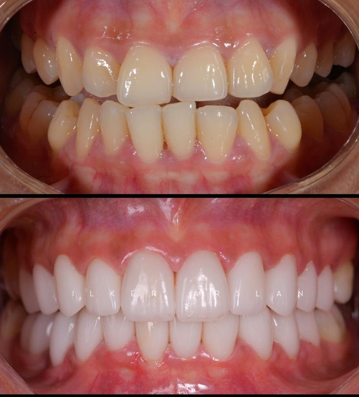 طبيب أسنان طنجة - مركز ديفينا لطب الأسنان | الدكتورة ندى لهيبشي، أخصائية في طب الأسنان التجميلي 2