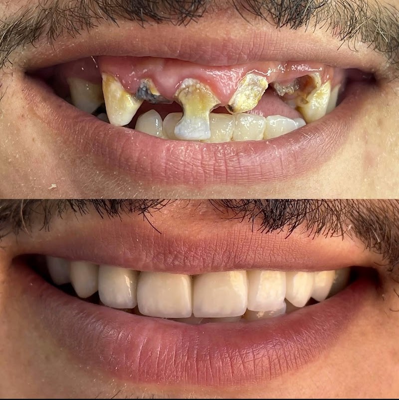 عيادة الأسنان د. مريم زريولي جراح أسنان 2