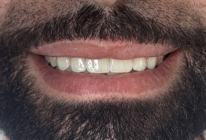 عيادة الأسنان د. مريم زريولي جراح أسنان 4