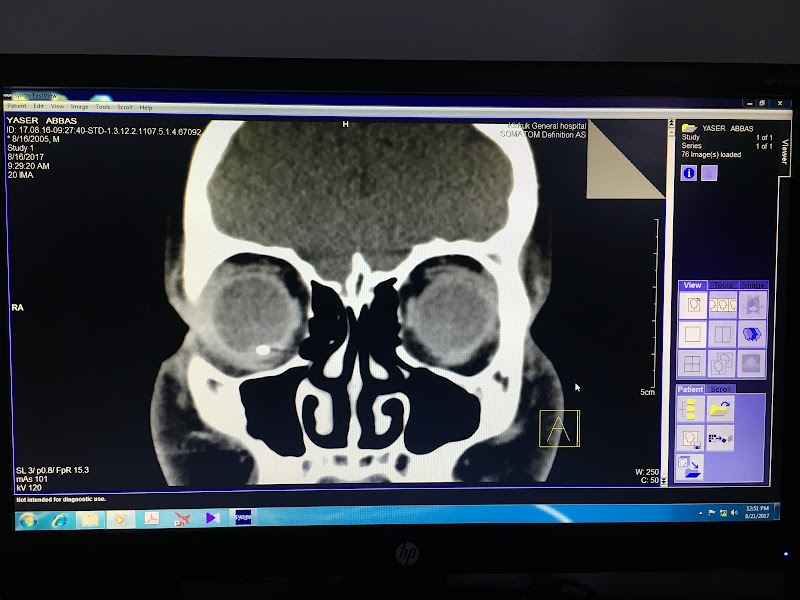 المركز الامريكي للعيون