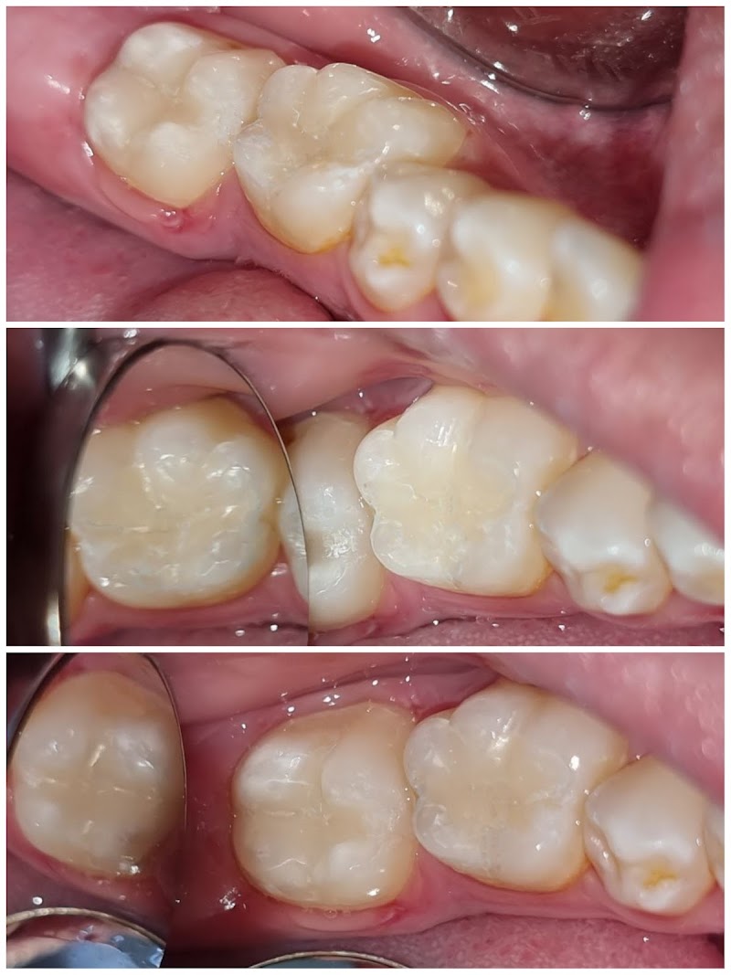 عيادة هيرو للأسنان 2