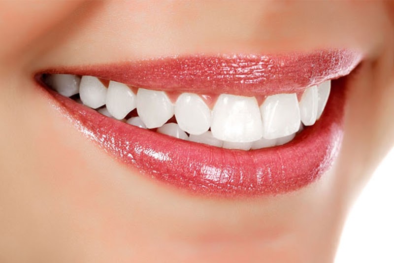 عيادة هيرو للأسنان 3