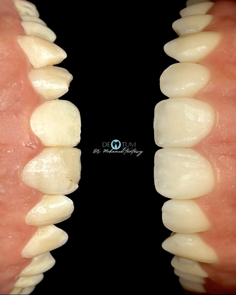 عيادة دينتم لطب الأسنان