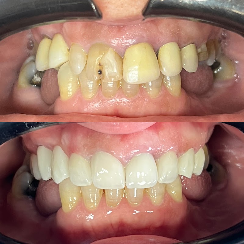 طبيب أسنان وجدة د. أسامة علا جراح أسنان ومتعدد التخصصات 3