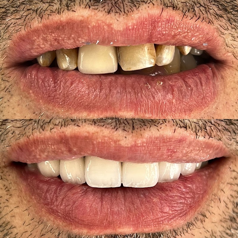 طبيب أسنان وجدة د. أسامة علا جراح أسنان ومتعدد التخصصات 4