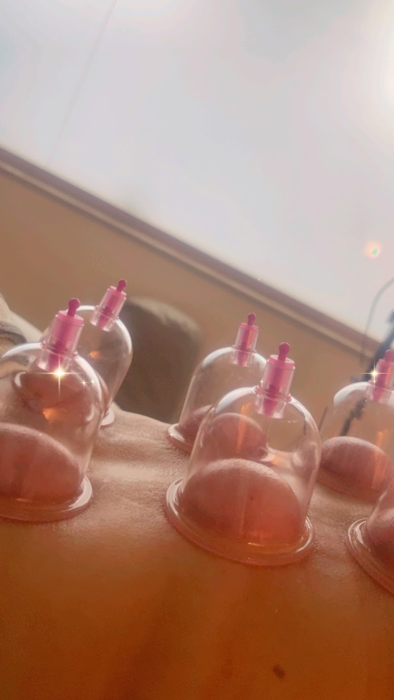 مركز سكالي للعلاج بالحجامة والطب الشمولي