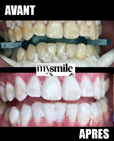 طبيب أسنان طنجة، الدكتور الأخضر فاتين- عيادة ماي سمايل (تبييض، تقويم، طوارئ)