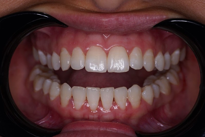 الدكتور أبو بكر بوعسل - عيادة أسنان متخصصة 2