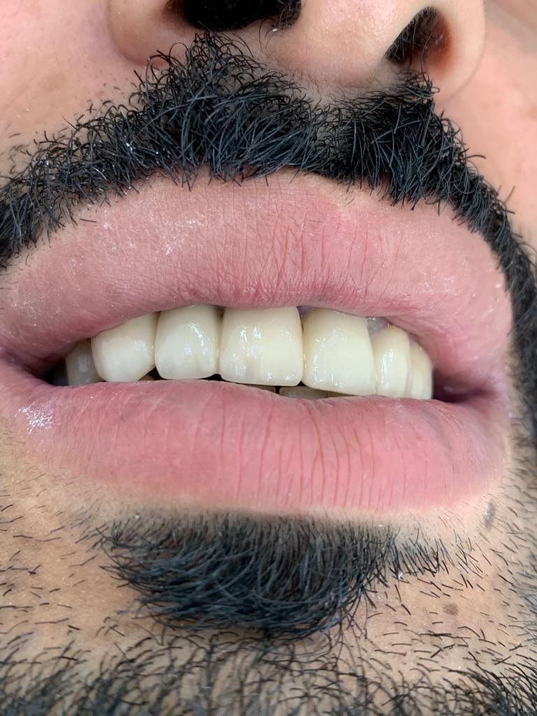 مركز الأسنان نيا هابنس 3